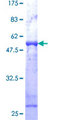 VAPB Protein - 12.5% SDS-PAGE of human VAPB stained with Coomassie Blue
