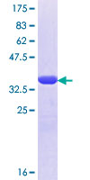 VAPB Protein - 12.5% SDS-PAGE Stained with Coomassie Blue.
