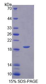 VAPB Protein - Recombinant  Vesicle Associated Membrane Protein Associated Protein B By SDS-PAGE
