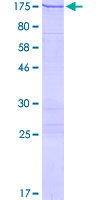 VARS / ValRS Protein - 12.5% SDS-PAGE of human VARS stained with Coomassie Blue