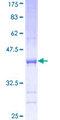 VARS / ValRS Protein - 12.5% SDS-PAGE Stained with Coomassie Blue.