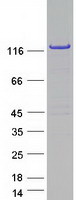 VARS / ValRS Protein - Purified recombinant protein VARS was analyzed by SDS-PAGE gel and Coomassie Blue Staining