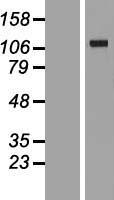 VARS2 / ValRS Protein - Western validation with an anti-DDK antibody * L: Control HEK293 lysate R: Over-expression lysate