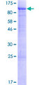 VASN / Vasorin Protein - 12.5% SDS-PAGE of human VASN stained with Coomassie Blue