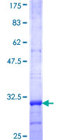 VASN / Vasorin Protein - 12.5% SDS-PAGE Stained with Coomassie Blue.
