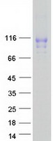 VASN / Vasorin Protein - Purified recombinant protein VASN was analyzed by SDS-PAGE gel and Coomassie Blue Staining