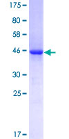Vasohibin 1 / VASH1 Protein - 12.5% SDS-PAGE of human VASH1 stained with Coomassie Blue