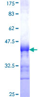 Vasohibin 1 / VASH1 Protein - 12.5% SDS-PAGE Stained with Coomassie Blue.