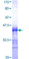 Vasohibin 1 / VASH1 Protein - 12.5% SDS-PAGE Stained with Coomassie Blue.
