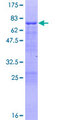 VASP Protein - 12.5% SDS-PAGE of human VASP stained with Coomassie Blue