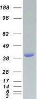 VASP Protein - Purified recombinant protein VASP was analyzed by SDS-PAGE gel and Coomassie Blue Staining