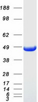 VAT1 Protein - Purified recombinant protein VAT1 was analyzed by SDS-PAGE gel and Coomassie Blue Staining