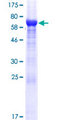 VAT1L Protein - 12.5% SDS-PAGE of human KIAA1576 stained with Coomassie Blue