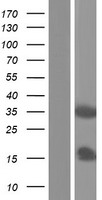 VAX1 Protein - Western validation with an anti-DDK antibody * L: Control HEK293 lysate R: Over-expression lysate