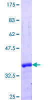 VAX1 Protein - 12.5% SDS-PAGE Stained with Coomassie Blue.