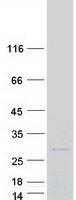 VAX1 Protein - Purified recombinant protein VAX1 was analyzed by SDS-PAGE gel and Coomassie Blue Staining