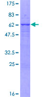 VAX2 Protein - 12.5% SDS-PAGE of human VAX2 stained with Coomassie Blue