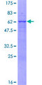 VAX2 Protein - 12.5% SDS-PAGE of human VAX2 stained with Coomassie Blue