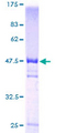 VBP1 Protein - 12.5% SDS-PAGE of human VBP1 stained with Coomassie Blue