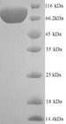 VCAM1 / CD106 Protein - (Tris-Glycine gel) Discontinuous SDS-PAGE (reduced) with 5% enrichment gel and 15% separation gel.