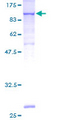 VCAM1 / CD106 Protein - 12.5% SDS-PAGE of human VCAM1 stained with Coomassie Blue