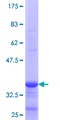 VCAM1 / CD106 Protein - 12.5% SDS-PAGE Stained with Coomassie Blue.