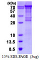 VCAM1 / CD106 Protein