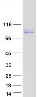 VCAM1 / CD106 Protein - Purified recombinant protein VCAM1 was analyzed by SDS-PAGE gel and Coomassie Blue Staining