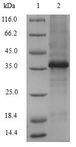 VCAN / Versican Protein - (Tris-Glycine gel) Discontinuous SDS-PAGE (reduced) with 5% enrichment gel and 15% separation gel.