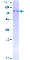VCAN / Versican Protein - 12.5% SDS-PAGE of human CSPG2 stained with Coomassie Blue