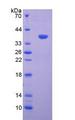 VCAN / Versican Protein - Recombinant Versican By SDS-PAGE