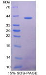 VCC-1 / CXCL17 Protein - Recombinant VEGF Co Regulated Chemokine 1 By SDS-PAGE