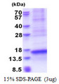 VCC-1 / CXCL17 Protein