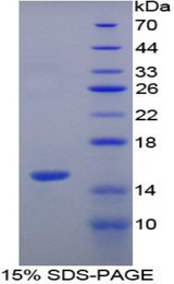 VCL / Vinculin Protein - Recombinant Vinculin By SDS-PAGE