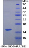 VCL / Vinculin Protein - Recombinant Vinculin By SDS-PAGE