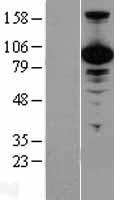 VCP Protein - Western validation with an anti-DDK antibody * L: Control HEK293 lysate R: Over-expression lysate