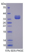VCP Protein - Recombinant Valosin Containing Protein By SDS-PAGE