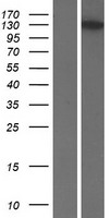VCPIP1 Protein - Western validation with an anti-DDK antibody * L: Control HEK293 lysate R: Over-expression lysate