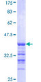 VCPIP1 Protein - 12.5% SDS-PAGE Stained with Coomassie Blue.