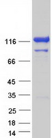 VCPIP1 Protein - Purified recombinant protein VCPIP1 was analyzed by SDS-PAGE gel and Coomassie Blue Staining