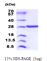 VCPKMT / C14orf138 Protein