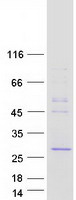 VCPKMT / C14orf138 Protein - Purified recombinant protein VCPKMT was analyzed by SDS-PAGE gel and Coomassie Blue Staining