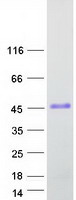 VCX Protein - Purified recombinant protein VCX was analyzed by SDS-PAGE gel and Coomassie Blue Staining