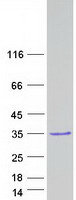 VCX2 Protein - Purified recombinant protein VCX2 was analyzed by SDS-PAGE gel and Coomassie Blue Staining