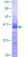 VCX3A Protein - 12.5% SDS-PAGE Stained with Coomassie Blue.