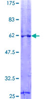 VDAC1 / PORIN Protein - 12.5% SDS-PAGE of human VDAC1 stained with Coomassie Blue