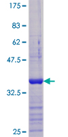 VDAC1 / PORIN Protein - 12.5% SDS-PAGE Stained with Coomassie Blue.