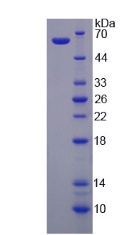 VDAC1 / PORIN Protein - Recombinant Voltage Dependent Anion Channel Protein 1 By SDS-PAGE