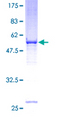 VDAC2 Protein - 12.5% SDS-PAGE of human VDAC2 stained with Coomassie Blue