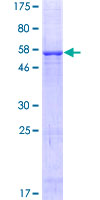 VDAC3 Protein - 12.5% SDS-PAGE of human VDAC3 stained with Coomassie Blue